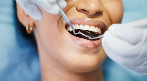 Best Broken or Chipped Tooth Repair in Dunsmuir, CA