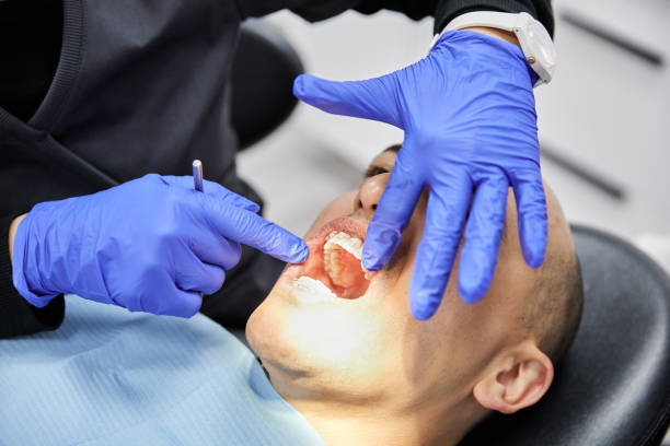 Best Dental Abscess Treatment in Dunsmuir, CA